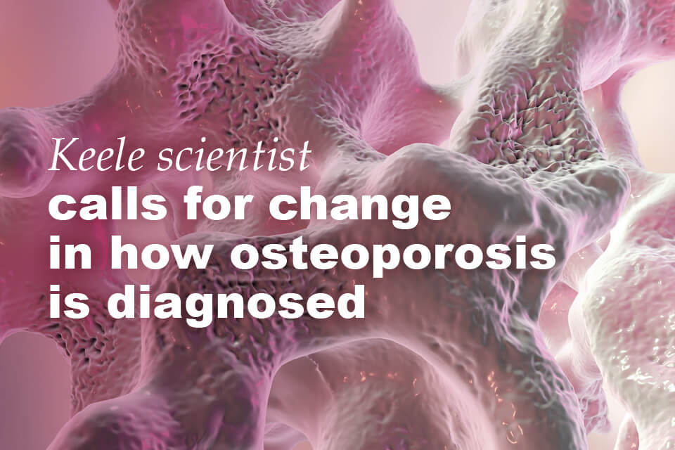 Keele scientist calls for change in how osteoporosis is diagnosed