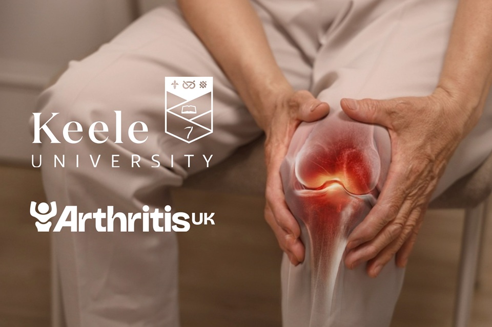 Keele researcher co-leading new study into why osteoarthritis impacts patients differently