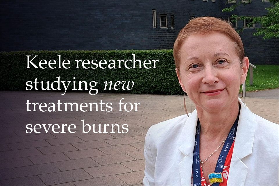 Keele researcher secures funding to help treat war-related burn injuries in Ukraine