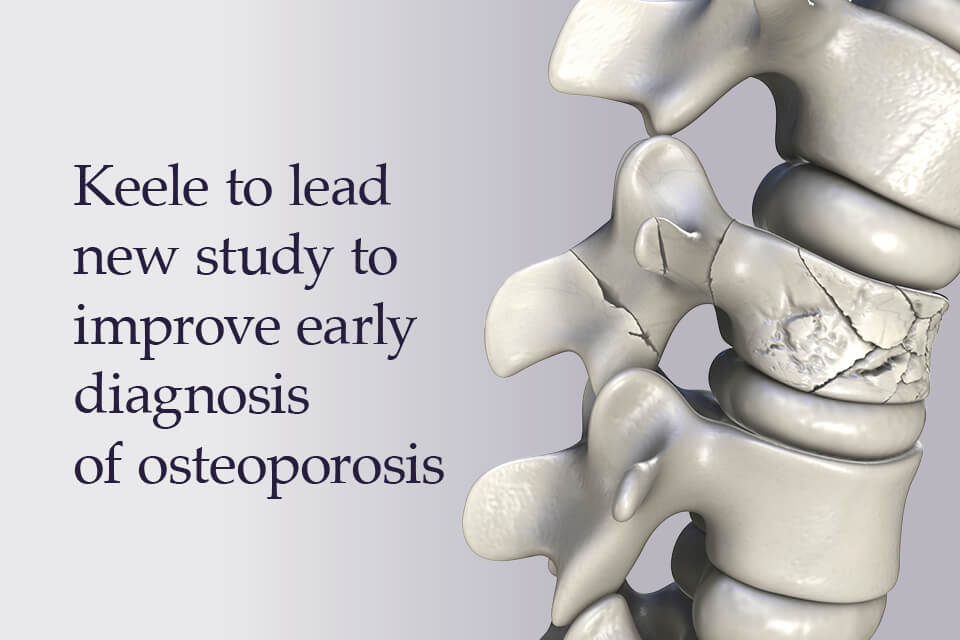 Keele to lead new study to improve early diagnosis of osteoporosis