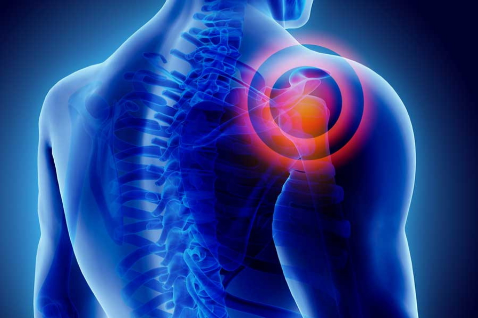 Shoulder pain