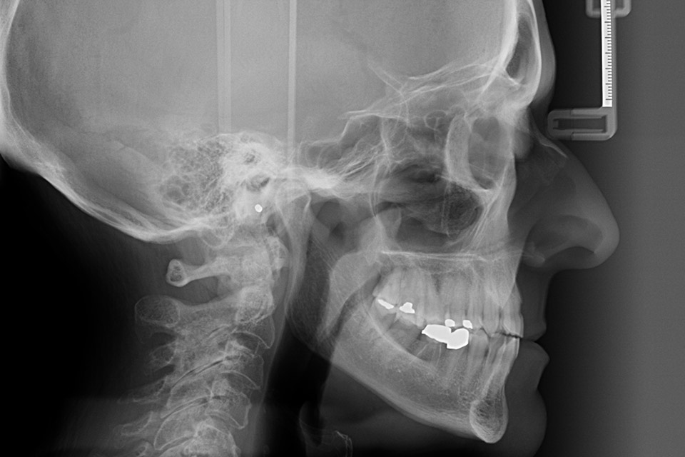 Prevention, performance and rehabilitation