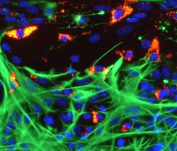 Microglia in a spinal cord slice transecting injury site showing avid loading and competitive uptake of nanoparticles (red) versus slice astrocytes (green). Nuclei in blue, photo Alan Weightman 