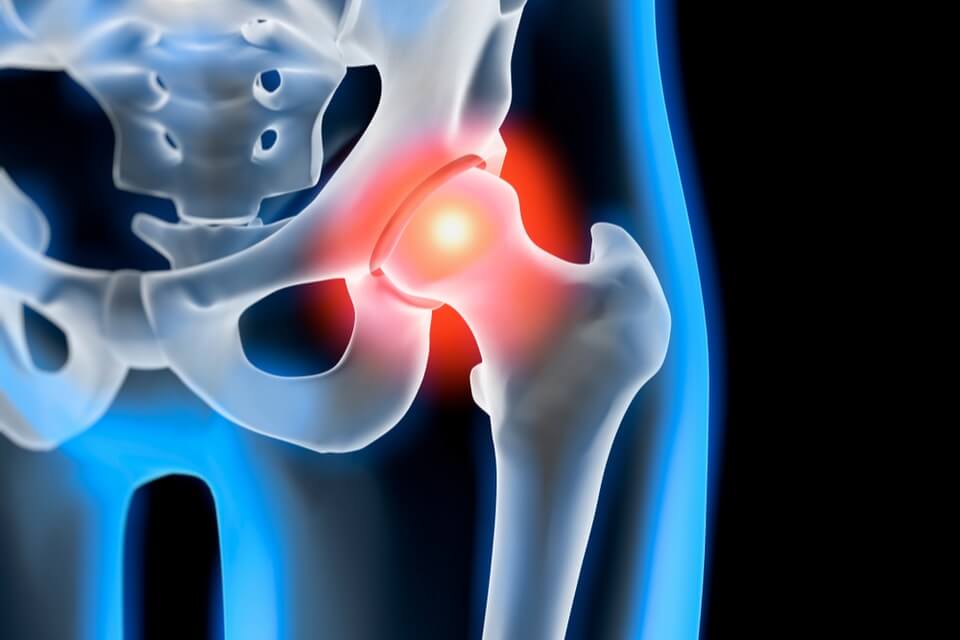 Steroid injections provide effective relief for arthritis patients