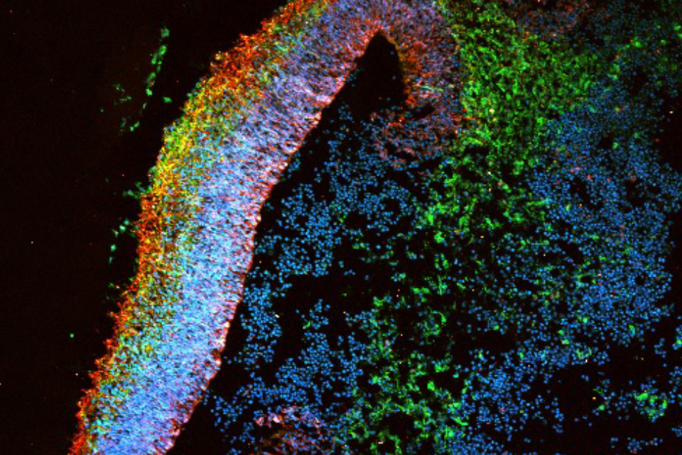 Neuroscience and Neurology