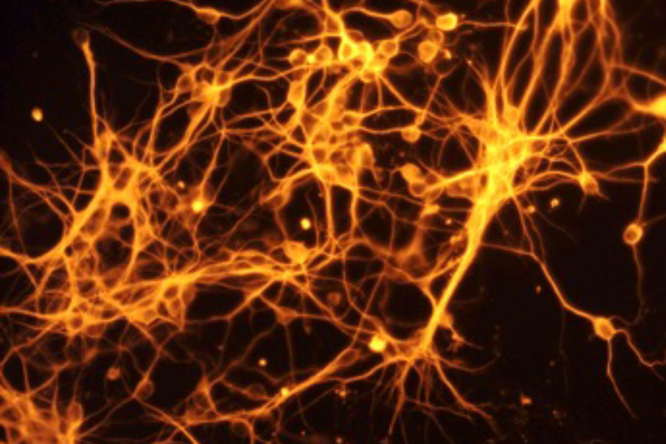 Neuroscience and Neurology