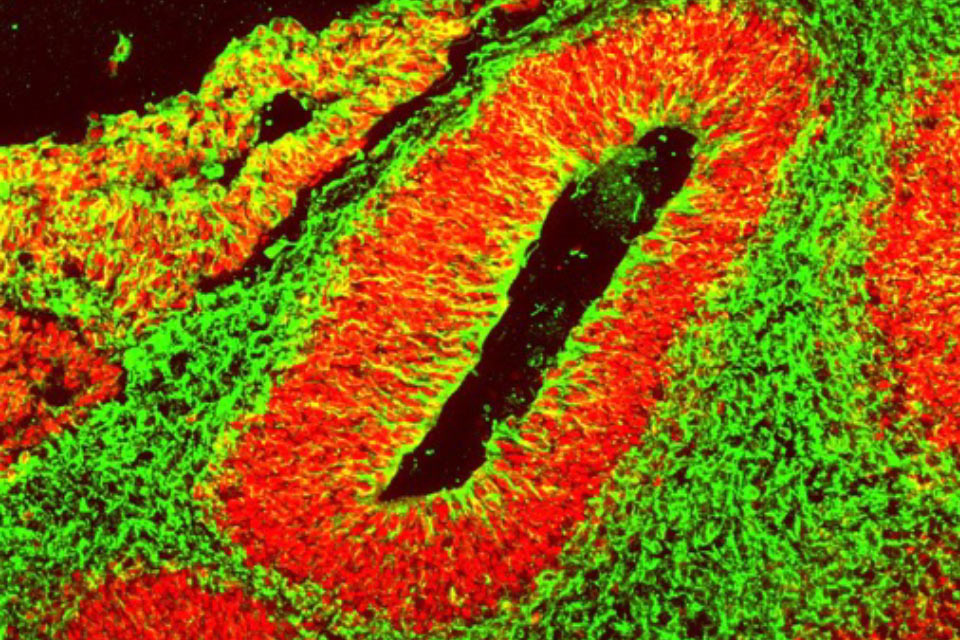 Neuroscience and Neurology