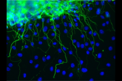 Regenerative medicine: nerve