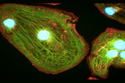 Regenerative medicine: heart