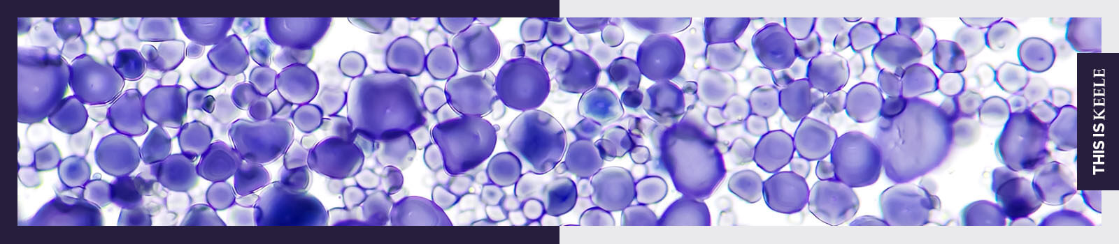 Cells under a microscope