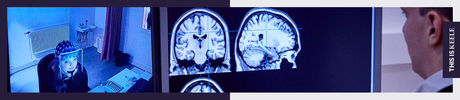 Computer screen showing brain scans