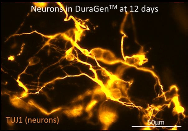 The image shows stem cell derived neurons growing in a neurosurgical grade biomaterial used widely in surgical procedures