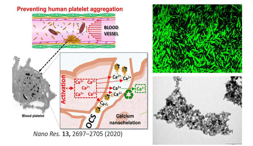 Nanomagnetic particles for treatment and diagnosis of cardiovascular diseases