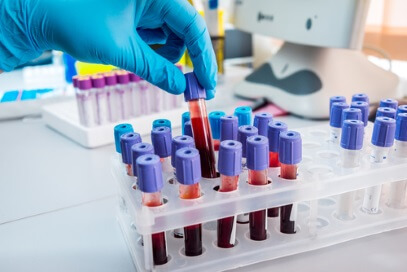 MSc Biomedical Science - Blood Science